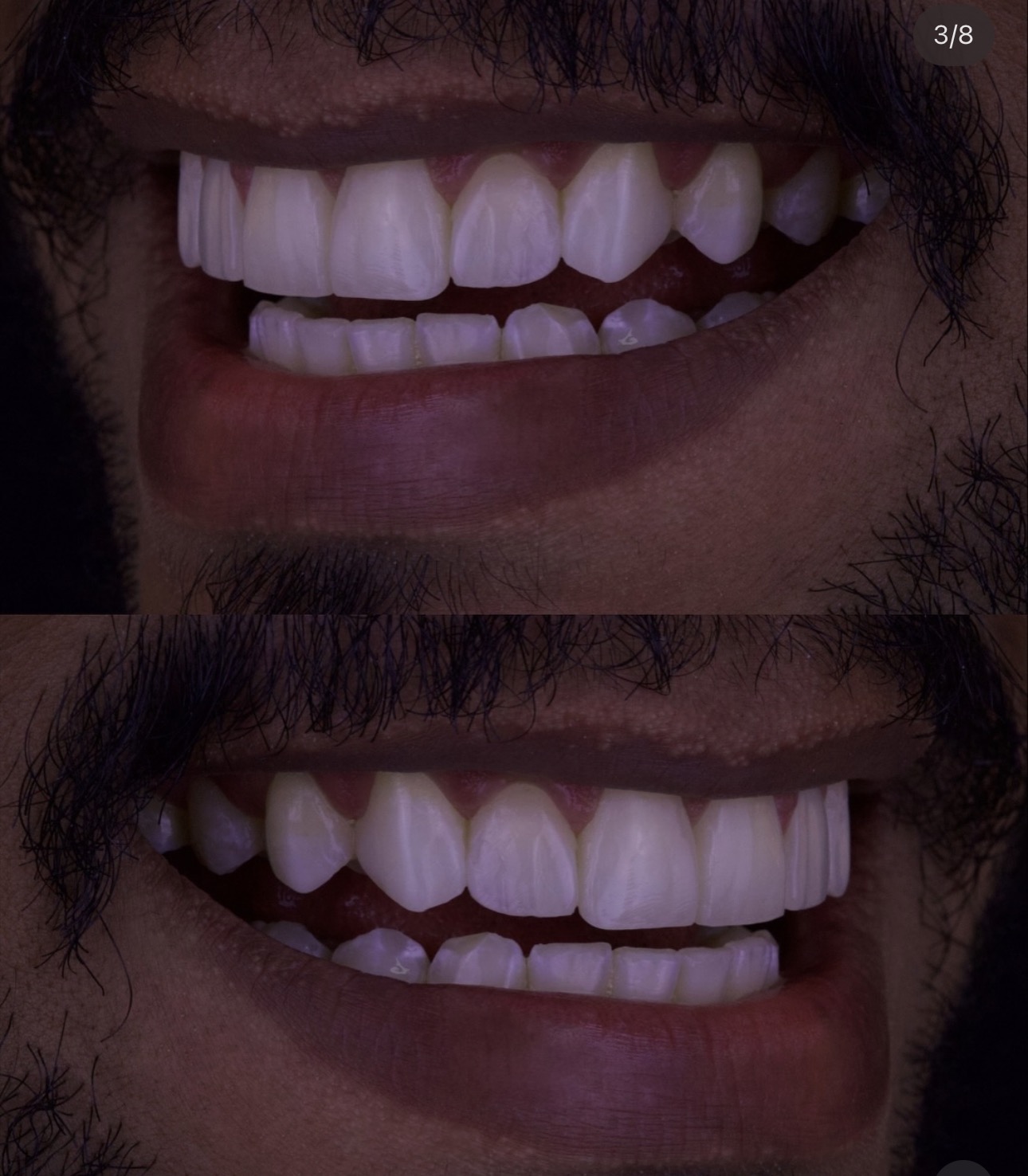 Registros de resultado de tratamento do sorriso na Odontoclycie